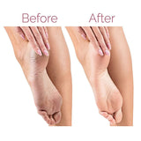 Rechargeable Electric Foot Callus Remover