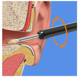 Smart Visual Earwax Removal Kit