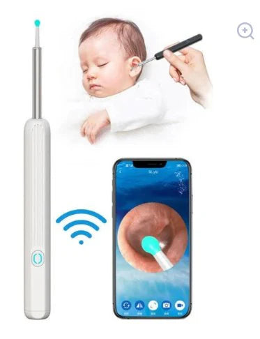 Smart Visual Earwax Removal Kit