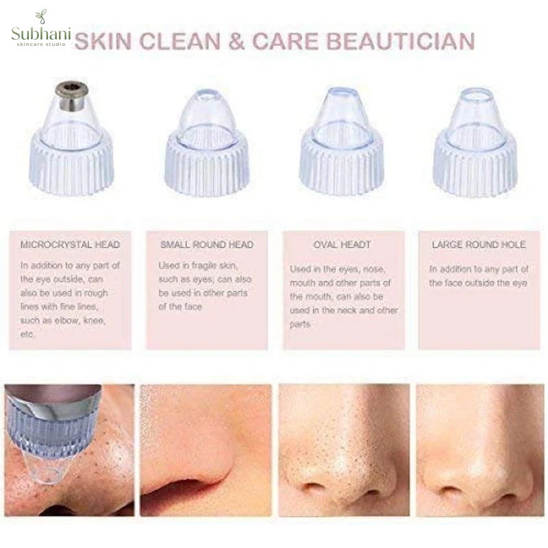 Electric Blackhead Remover Vacuum