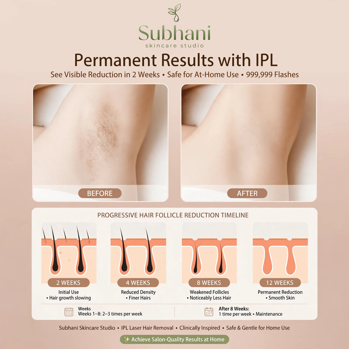 Babyverse IPL Hair Removal Device